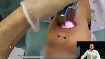 Aperfeiçoamento em Intubação Orotraqueal Pediátrica